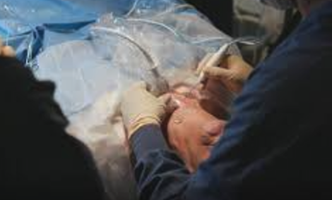 procedimento tireoide